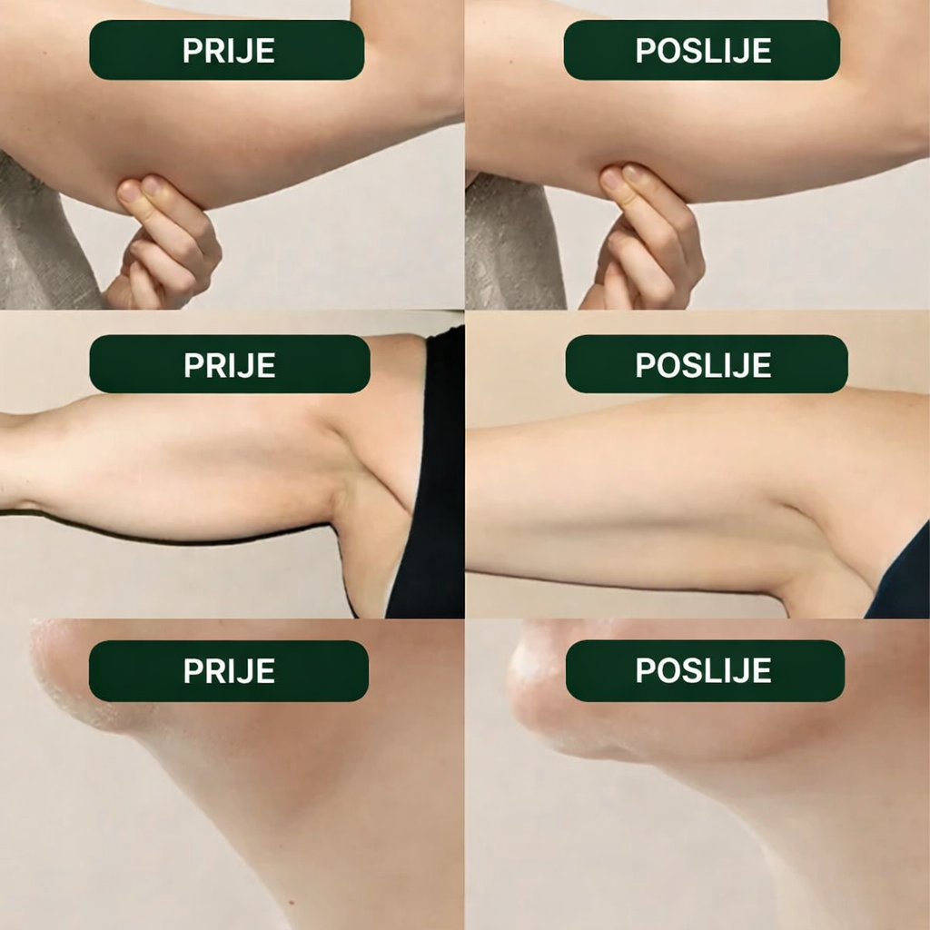 Nardo Detoks - Limfna Drenaža i Smanjenje Nadutosti